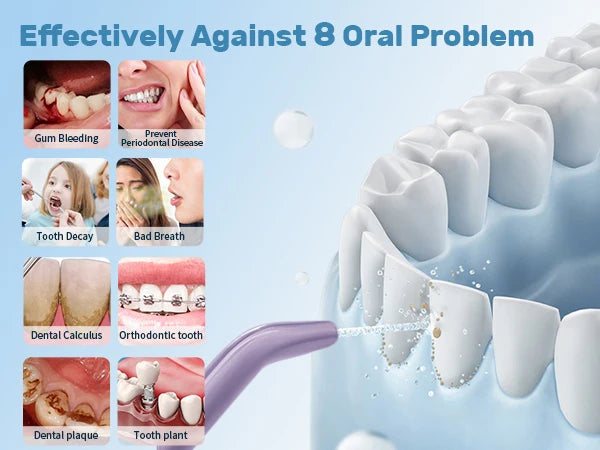 SEJOY Dental Oral Irrigator USB Rechargeable Teeth Cleaner Portable Dental Water Flosser 5 Modes IPX7 Mouth Washing Machine 350m